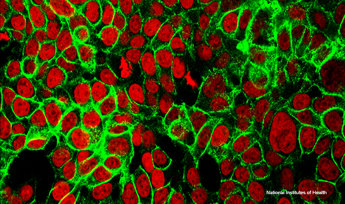 human colon cancer cells